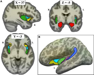 Neural evidence for non-orofacial triggers in mild misophonia